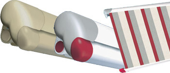 markilux-1600_vielfalt3